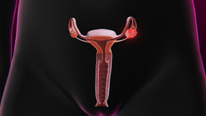 3D人体医疗卵巢癌15秒视频