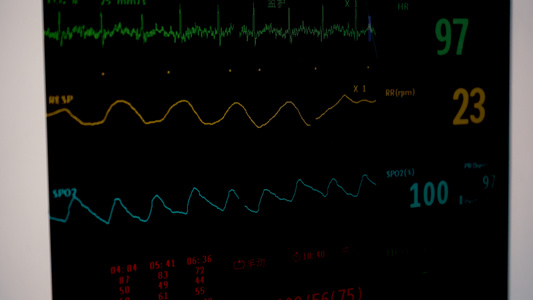 8k实拍医院病房监护仪视频