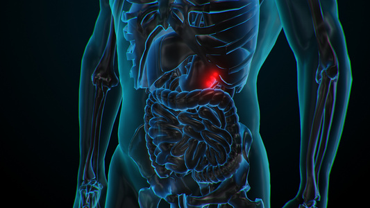 3D人体医疗胃炎胃癌疾病展示视频