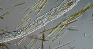 显微镜下的浮游生物或藻类微生物31秒视频