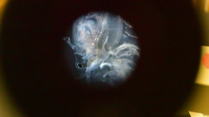 显微镜下的螨虫12秒视频