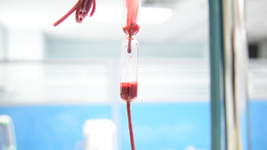 住院病人从血袋中滴血的血滴8秒视频