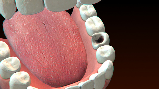 3D人体医疗牙周炎视频