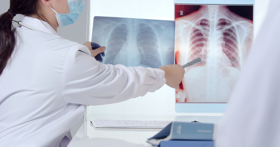 8K医生对比讲解病人的肺部CT片视频