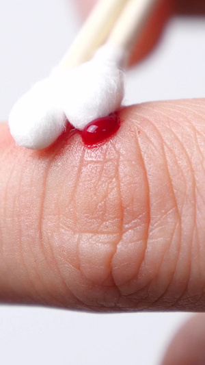 流血受伤伤口处理擦碘伏消毒消毒伤口23秒视频