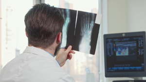 一名男性医生在看病人的脚X光片10秒视频