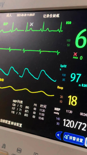 实拍医院监护设备生命体征15秒视频
