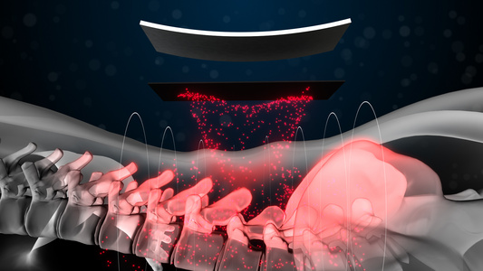 三维腰椎治疗效果医疗科普背景视频[3D立体]视频