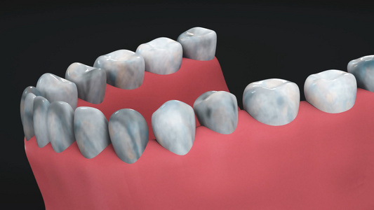 3d医疗牙齿老化动画视频