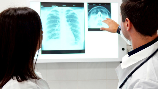 男性医生在X光片上向女性同事解释一些事情视频