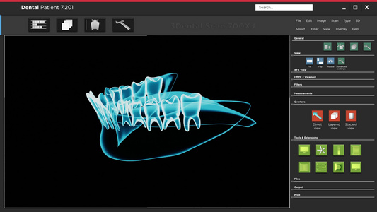 软件应用程序用户界面与牙科X光扫描的接口视频