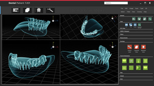 人体X光牙和扫描软件接口35秒视频