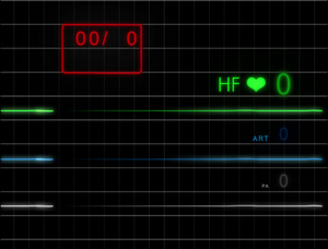 ECG监护仪无脉搏带网格4K20秒视频