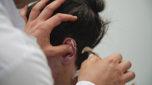 医生除去绷带以检查听耳整容手术后的女孩视频