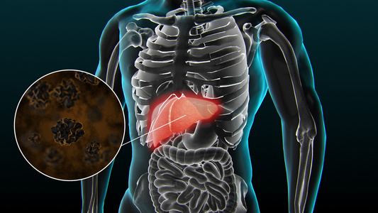 3D人体医疗 肝癌疾病展示视频