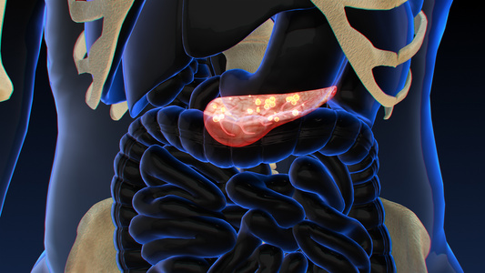 3D人体医疗胰腺癌视频