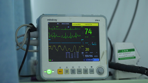 4k实拍医院重症监护心率检测仪27秒视频