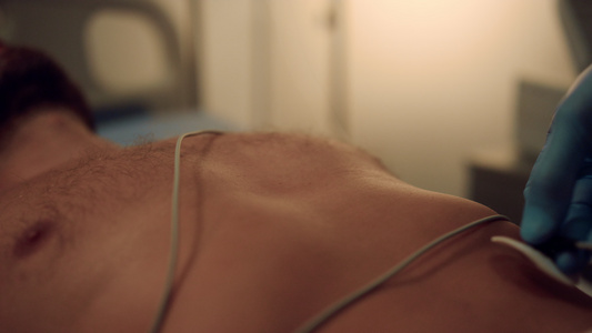 医生把心电图线放在病人胸口上医院心脏治疗视频