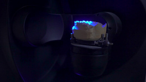 扫描仪中的牙齿印模16秒视频