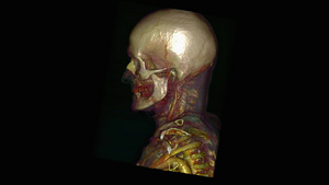 3d老人的头骨15秒视频