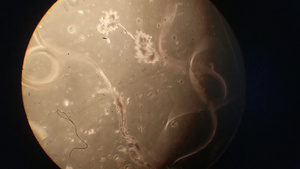 显微镜放大下的微生物21秒视频