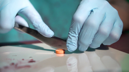 医生手在医学实验室血滴周围用桌上的刀手术刀将橙色药丸视频