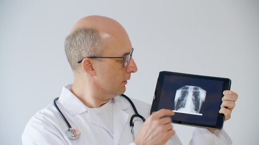 肺科医生在网上咨询中显示肺部计算透视与的切片治疗师视频