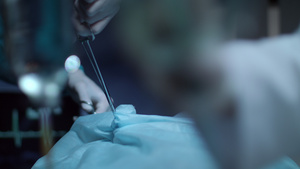 外科手术流程11秒视频