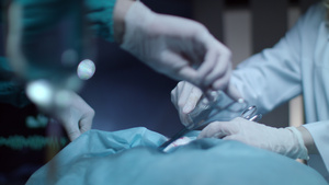 外科手术18秒视频