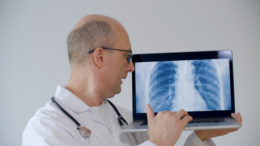 持有带有肺X射线图像的膝上型电脑的重度医生视频