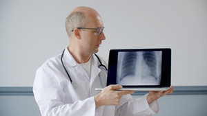 执业医生时在笔记本电脑屏幕上显示肺荧光图21秒视频