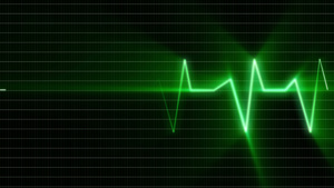 医疗监视器上的心脏脉冲序列10秒视频
