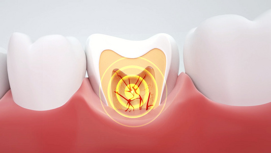 3d牙齿疼痛动画视频