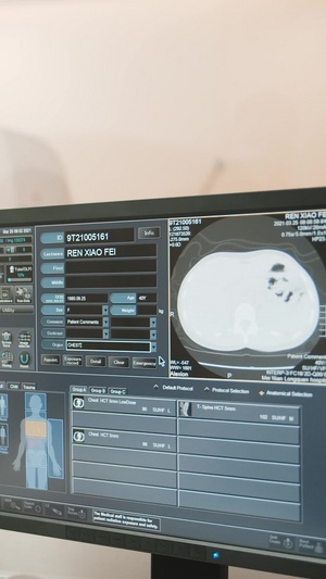 实拍电脑屏幕CT检查结果医疗设备18秒视频