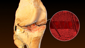 3D人体医疗骨关节炎15秒视频