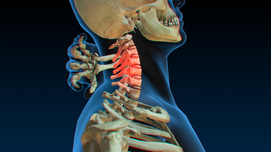 3D人体医疗颈椎病视频