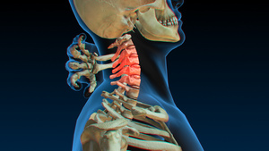 3D人体医疗颈椎病15秒视频