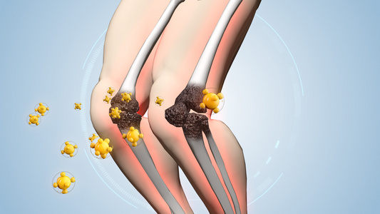 医学治疗骨骼关节过程示意背景视频视频
