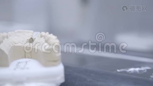 牙科诊所的人工下颌特写。准备做牙种植的牙医视频