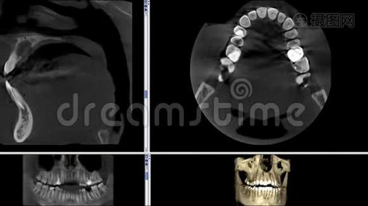 口腔医学、牙科研究、新质量医学、牙科影像动画的人颌骨成像扫描视频