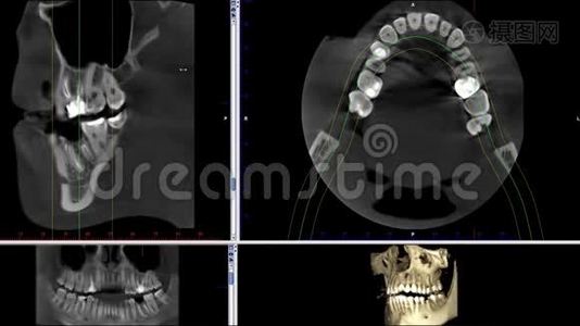 口腔医学、牙科研究、新质量医学、牙科影像动画的人颌骨成像扫描视频