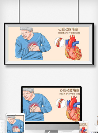 中年人心脏动脉堵塞科普医疗插画模板