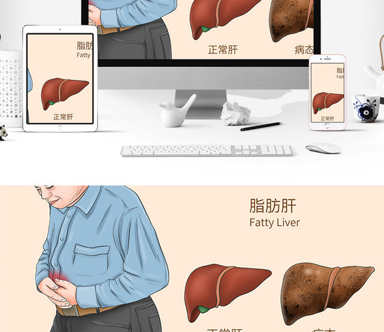 脂肪肝科普医疗插画图片