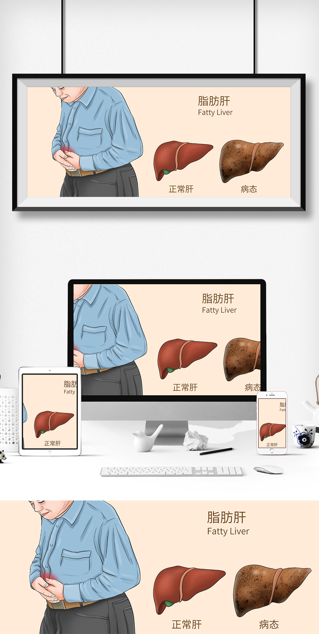 脂肪肝科普医疗插画图片素材
