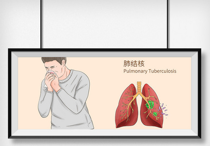 肺结核病科普医疗插画图片