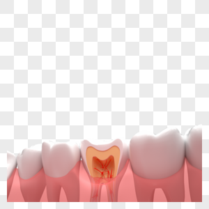 牙齿疾病图片
