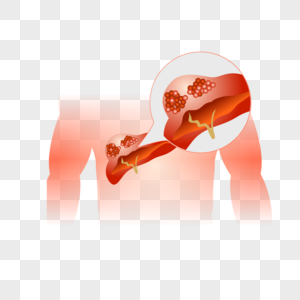 人体肝炎图片