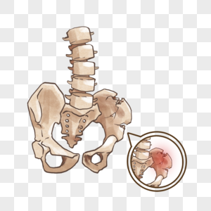 盆骨骨折图片