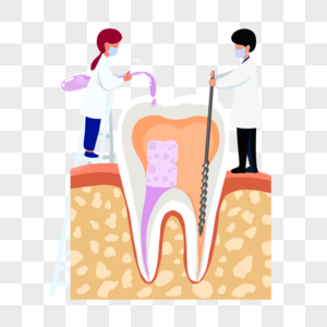 牙髓炎根管治疗高清图片