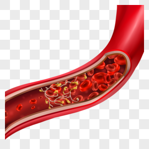 人体血管医学静脉血凝块插图高清图片